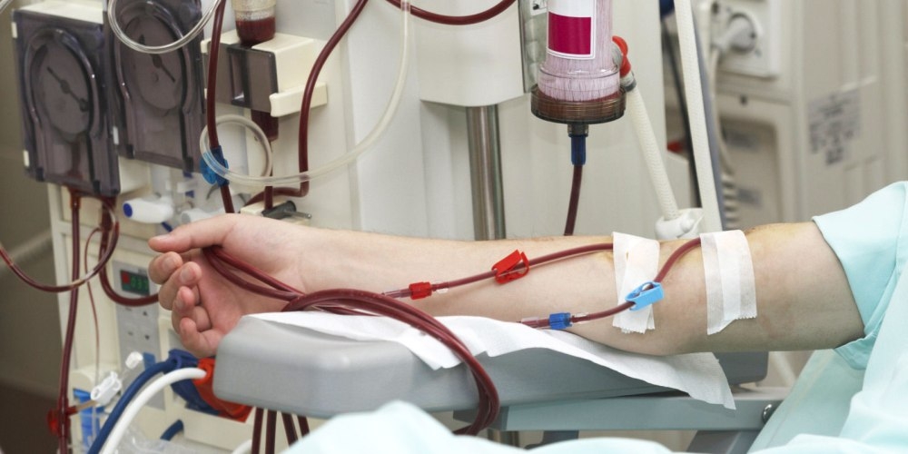 Минздрав КР передаст частной немецкой клинике часть гемодиализных больных