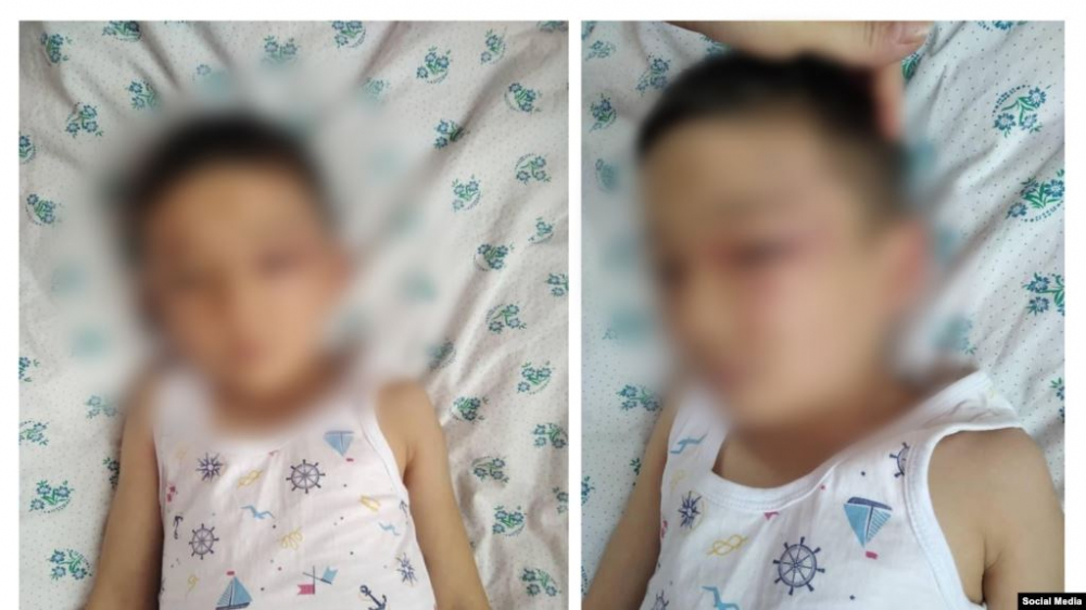 Адвокат шестилетнего мальчика, избитого отчимом, обратился в Генпрокуратуру