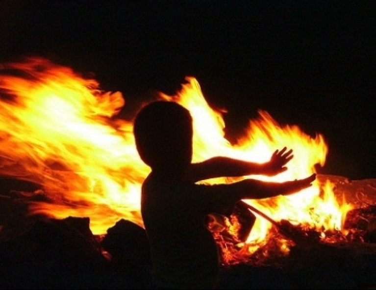 В Бишкеке при пожаре пострадали двое детей
