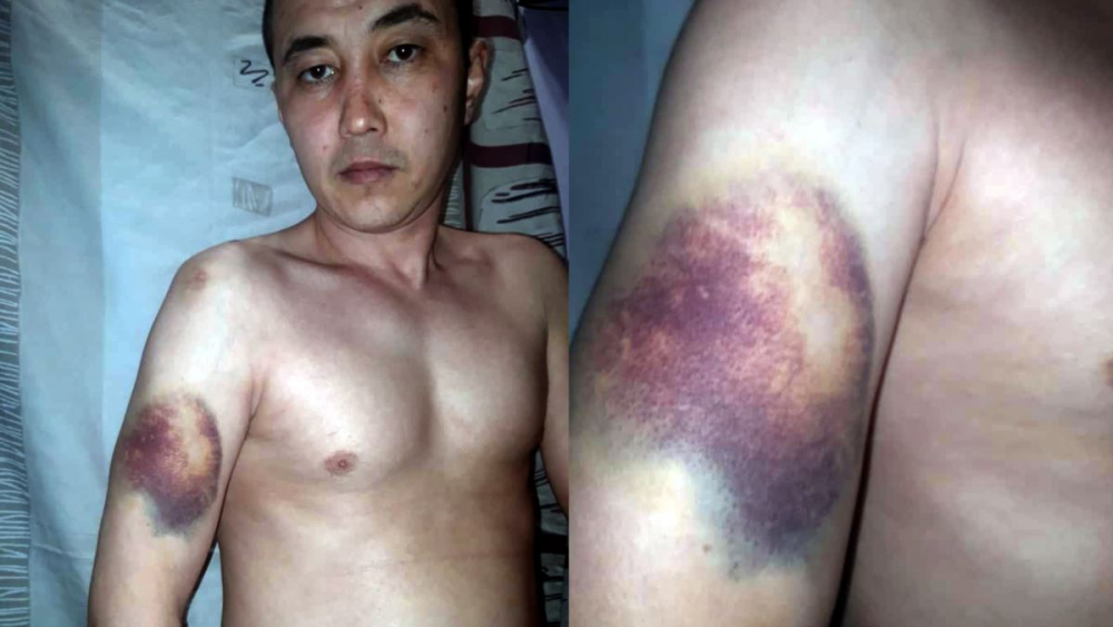 ГСИН: Эмилбек Кимсанов нечаянно упал с кровати и получил телесные повреждения