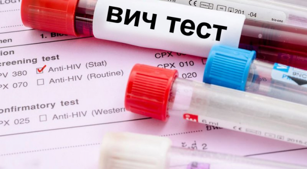 В Бишкеке можно пройти бесплатное тестирование на ВИЧ, сифилис и гепатит