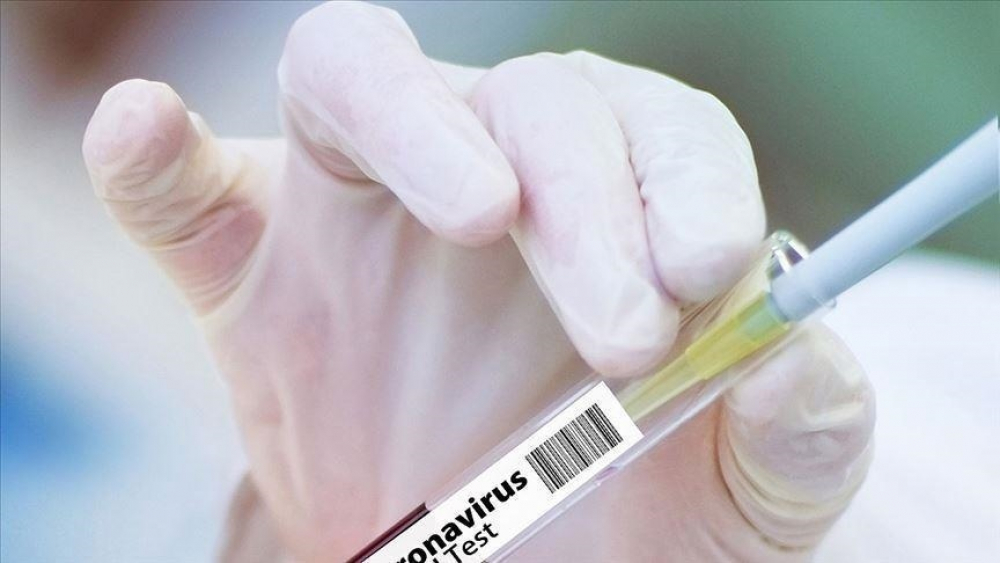Глава Минздрава испробует на себе китайскую вакцину Sinopharm
