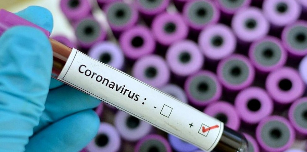 2 ноября. В Кыргызстане за сутки выявлено 98 случаев коронавируса