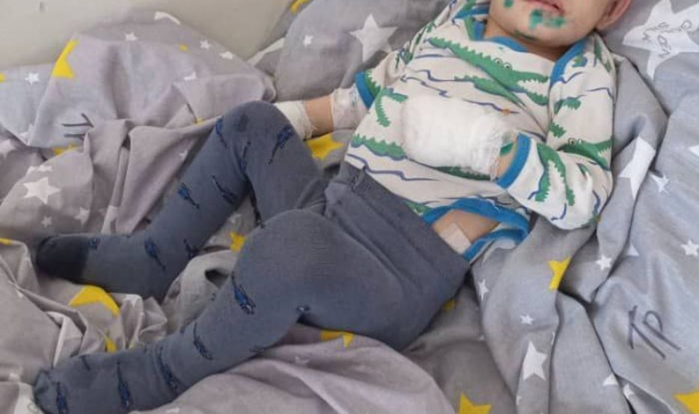 Отца и мать жестоко избитого в Сокулуке ребенка ограничили в родительских правах