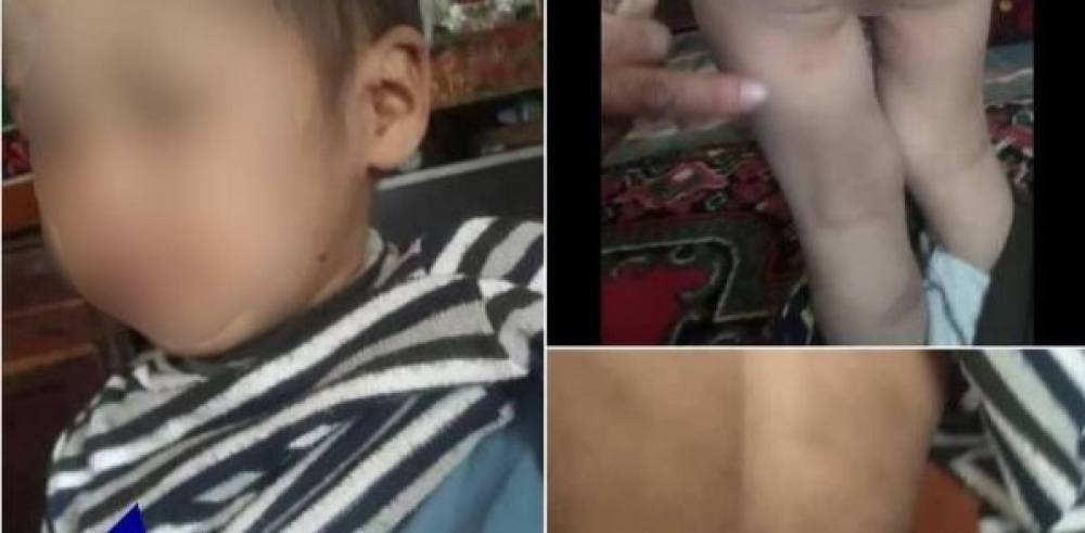 В Алае супруги жестоко избивали 3-летнего племянника, которого бросила мать